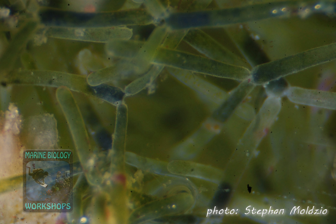 Green algae under 40x- magnification